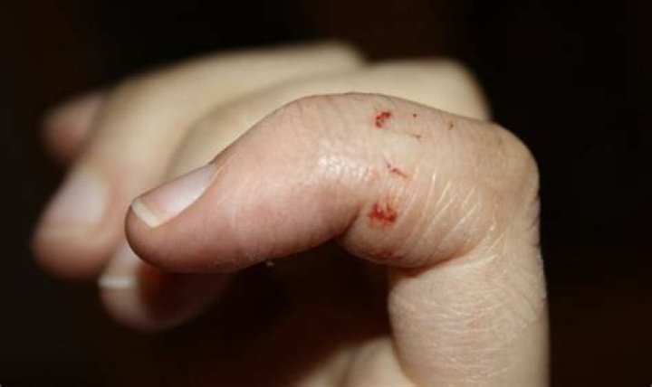 Do Water Rats bite?
