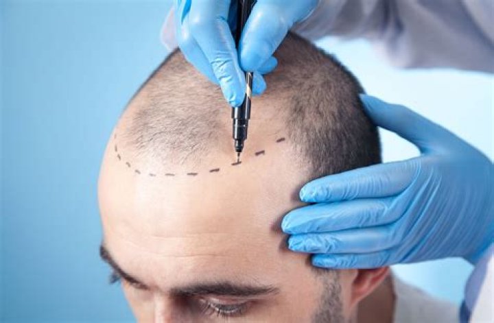 How much does it cost to shave a tire?