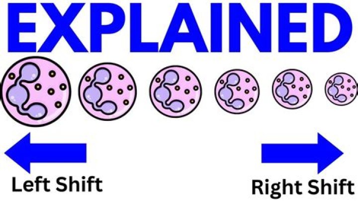 What does shift to the right mean in CBC?