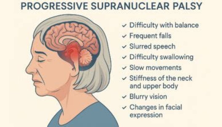 What is a supranuclear palsy?